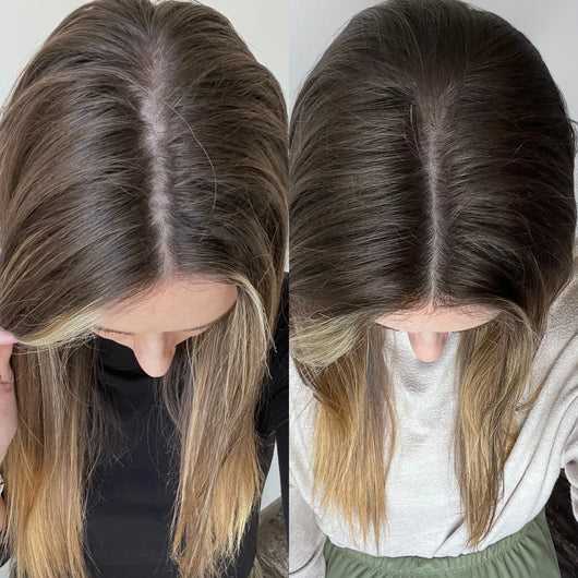 Hair Skin Nails